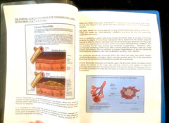 Percussionaire IPV Operational Manual The Family of IPV Percussionators